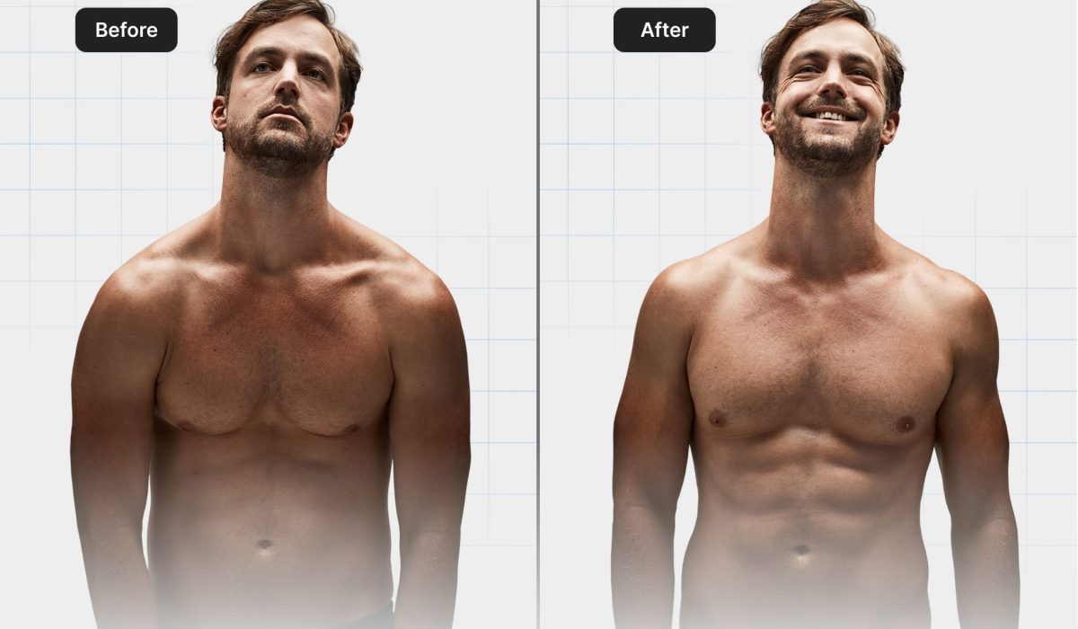 before-after-05.jpg